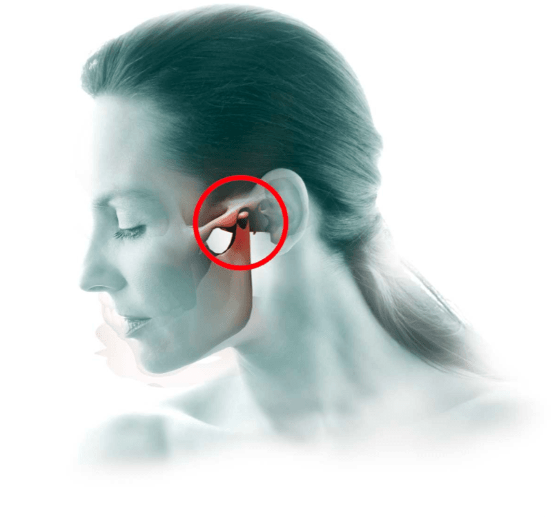 atm-dor-orofacial atm-dor-orofacial