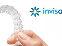 7 Principais Benefícios da Ortodontia com Invisalign