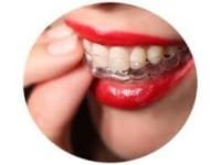 O Aparelho Ortodôntico Invisalign Funciona ?