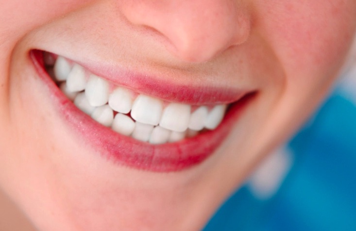 O que é Prótese Dentária Fixa?