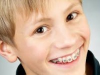 Aparelho Dentário Infantil