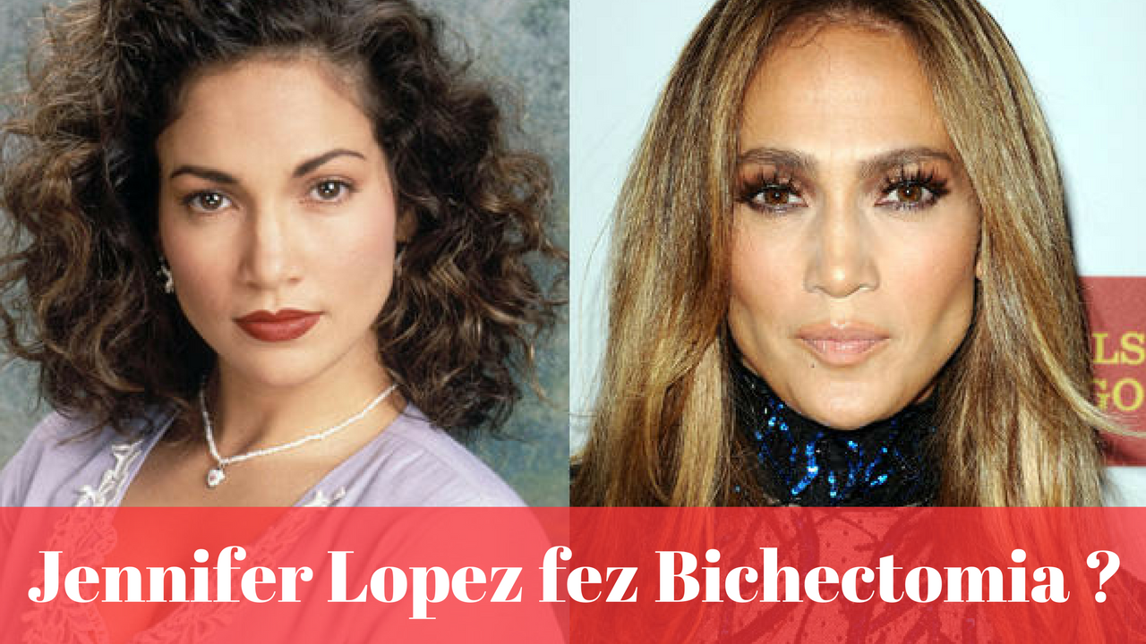 A Jennifer Lopez fez bichectomia
