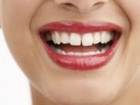 Diastema Dentes Separados eu não aguento mais …
