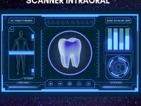 scanner intraoral do invisalign