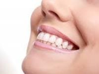 Invisalign em Campinas – Tire todas as suas dúvidas